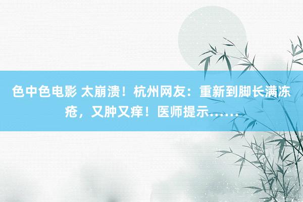 色中色电影 太崩溃！杭州网友：重新到脚长满冻疮，又肿又痒！医师提示……